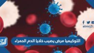 اللوكيميا مرض يصيب خلايا الدم الحمراء
