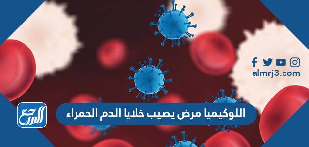 اللوكيميا مرض يصيب خلايا الدم الحمراء