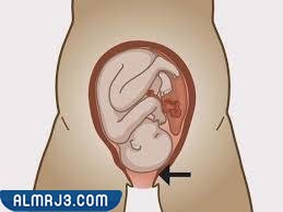 أسباب تأخر الولادة