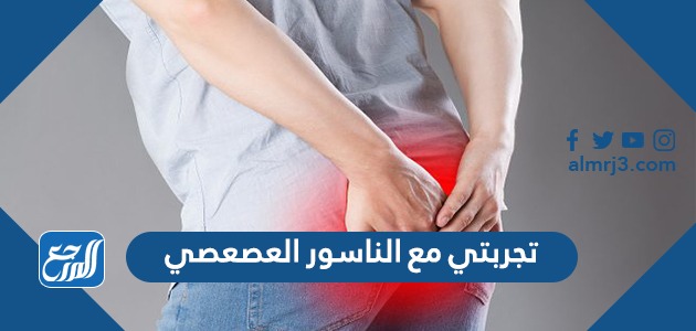 تجربتي مع الناسور العصعصي