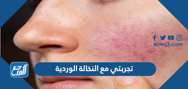 تجربتي مع النخالة الوردية