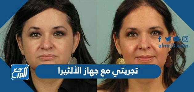 تجربتي مع جهاز الألثيرا