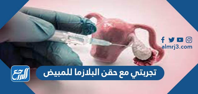 تجربتي مع حقن البلازما للمبيض