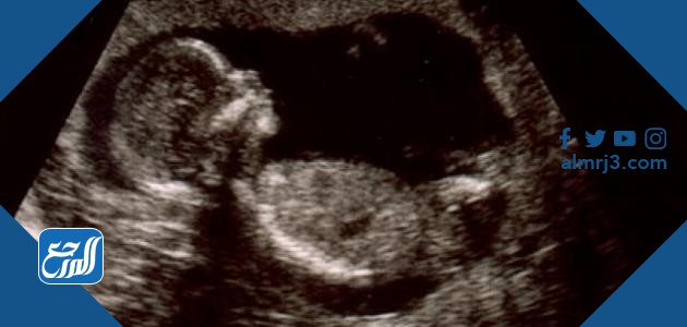 تحديد نوع الحنين