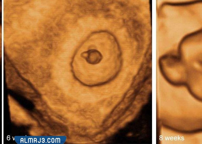 شكل كيس الجنين الذكر في الشهر الثاني