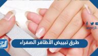 طرق تبييض الأظافر الصفراء