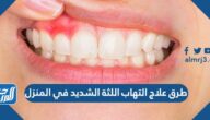 طرق علاج التهاب اللثة الشديد في المنزل