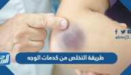 طريقة التخلص من كدمات الوجه