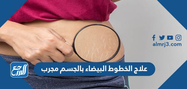 علاج الخطوط البيضاء بالجسم مجرب