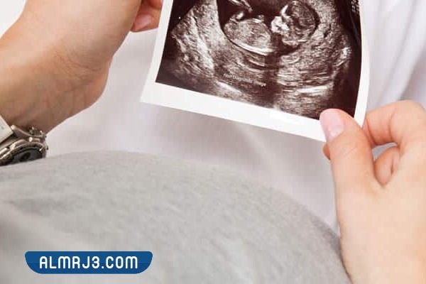 فحص تحديد جنس الجنين عن طريق السونار