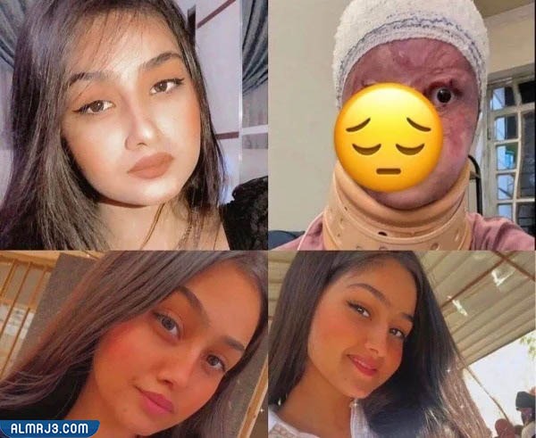 مريم الركابي قبل وبعد