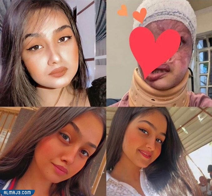 مريم الركابي قبل وبعد