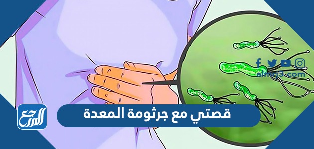 قصتي مع جرثومة المعدة