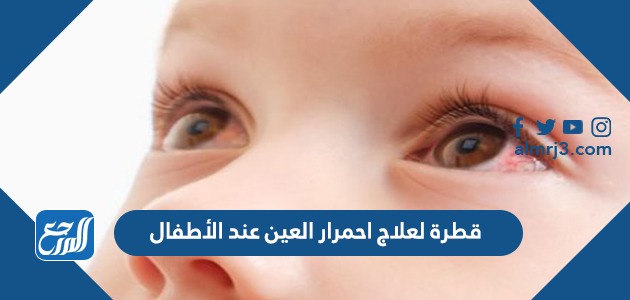 قطرة لعلاج احمرار العين عند الأطفال