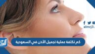 كم تكلفة عملية تجميل الأذن في السعودية