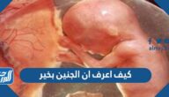 كيف اعرف ان الجنين بخير