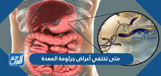 متى تختفي أعراض جرثومة المعدة