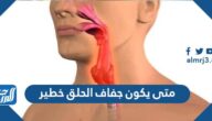 متى يكون جفاف الحلق خطير وعلاج جفاف الحلق