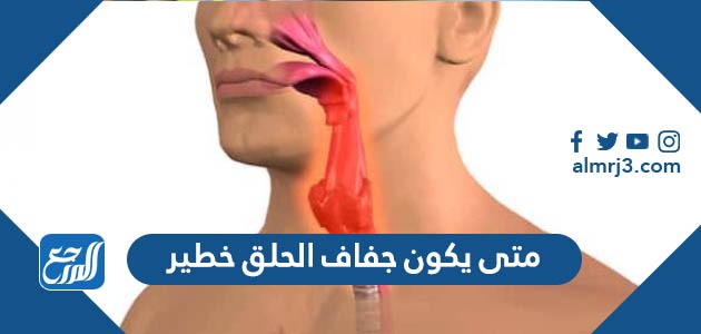 متى يكون جفاف الحلق خطير