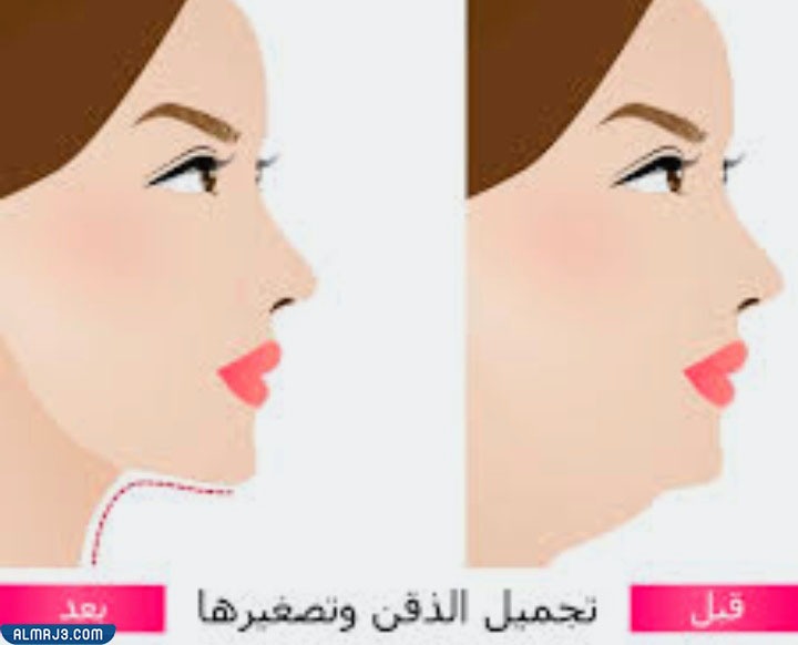 معلومات عن عمليات تحديد الفك وانواعها