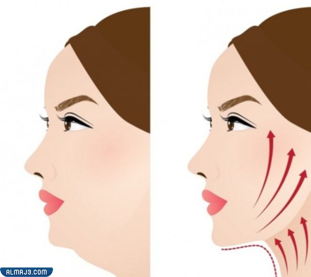 مميزات عمليات تحديد الفك