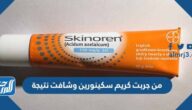 من جربت كريم سكينورين وشافت نتيجة