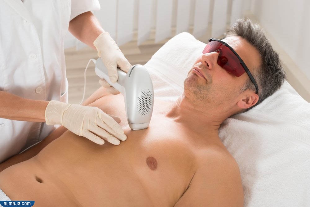 نتائج عملية إزالة الشعر بالليزر للرجال