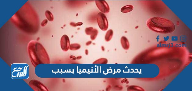 يحدث مرض الأنيميا بسبب..................