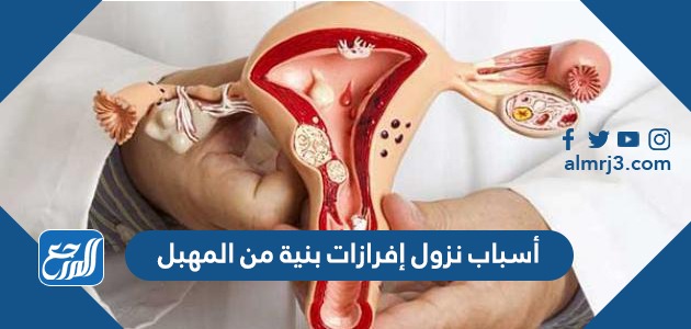 أسباب نزول إفرازات بنية من المهبل