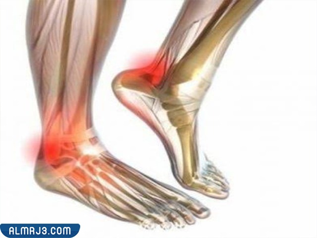 أعراض الالتهاب العصبي الطرفي