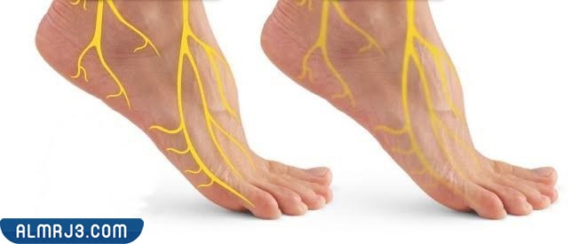 أنواع التهاب الأعصاب الطرفية