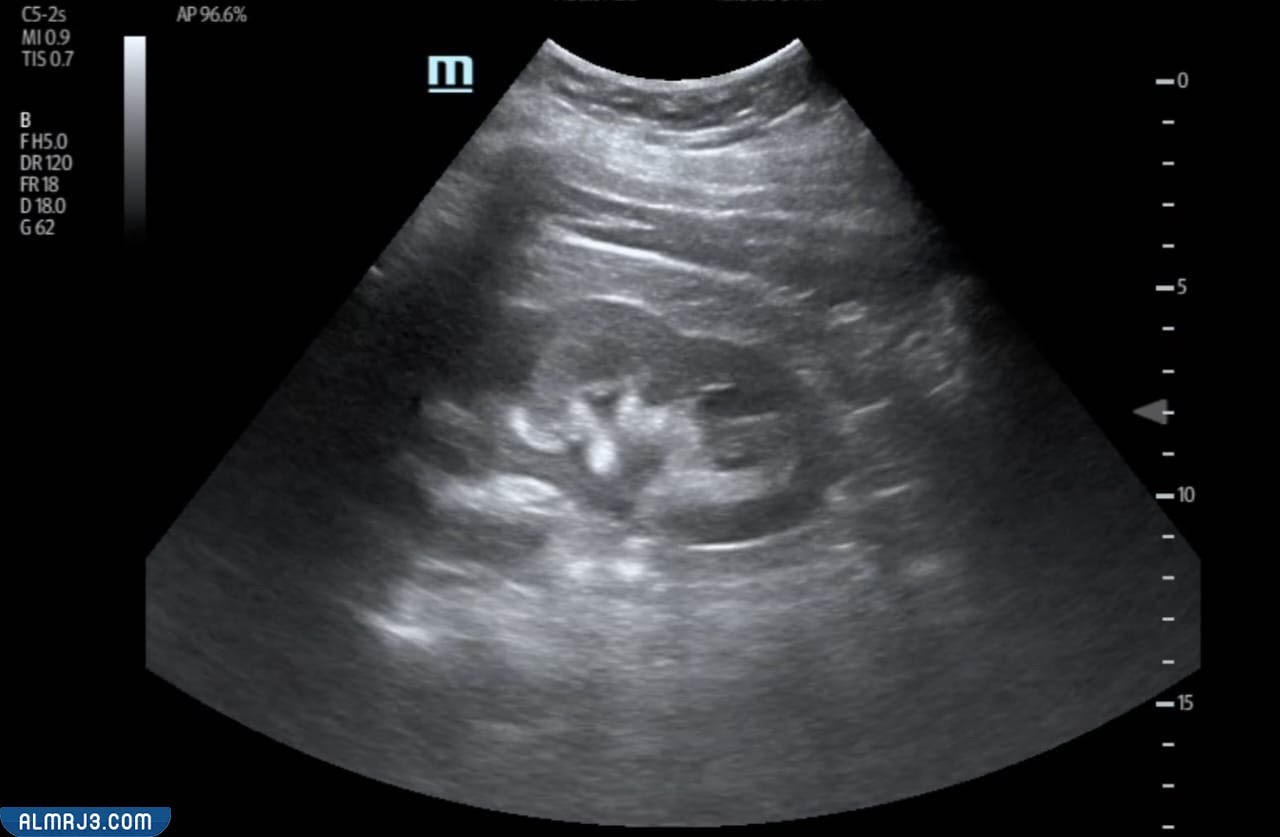 أهمية جهاز السونار