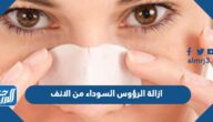 ازالة الرؤوس السوداء من الانف