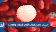 اسباب ارتفاع كريات الدم البيضاء والحمراء