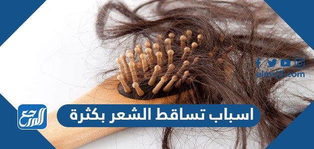اسباب تساقط الشعر بكثرة