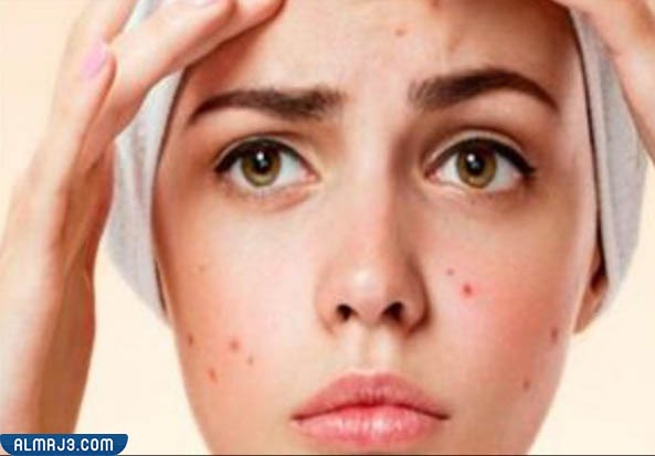 الآثار الجانبية لاستخدام الريتنول