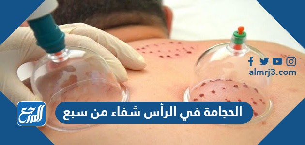 الحجامة في الرأس شفاء من سبع