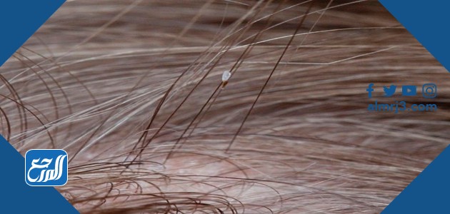 القمل والصيبان