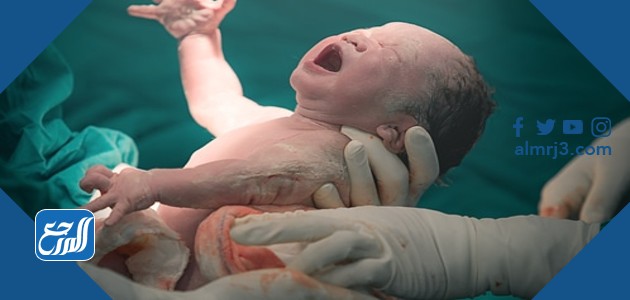 الولادة القيصرية