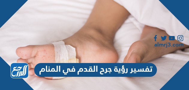 تفسير رؤية جرح القدم في المنام