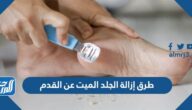 طرق إزالة الجلد الميت عن القدم