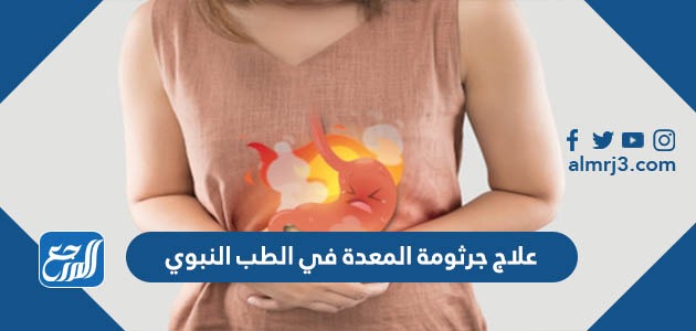 علاج جرثومة المعدة في الطب النبوي