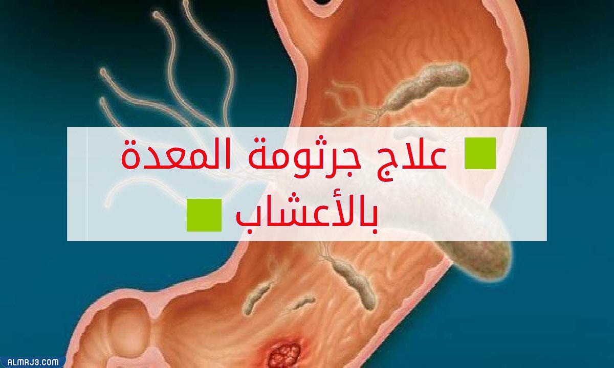 علاج جرثومة المعدة نهائيًا