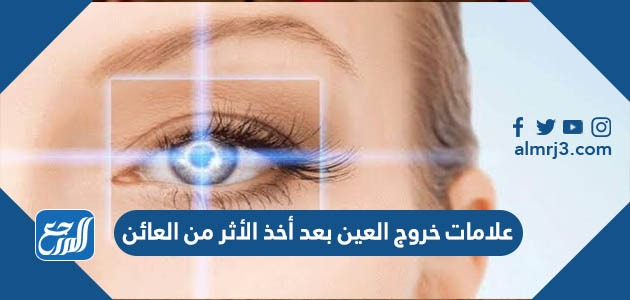 علامات خروج العين بعد أخذ الأثر من العائن