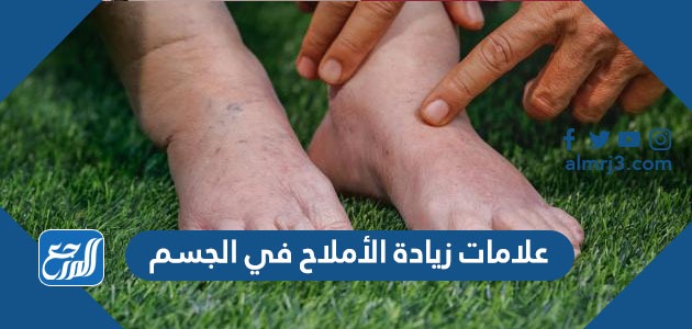 علامات زيادة الأملاح في الجسم