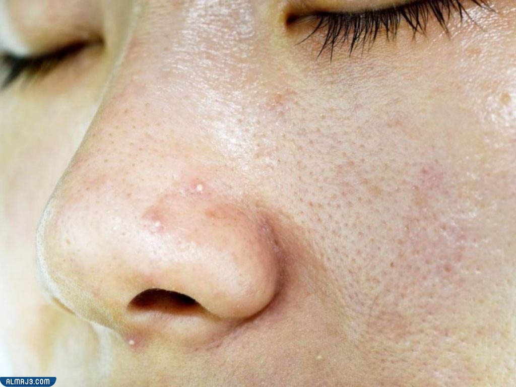 كريم مرطب بيوديرما للبشرة الدهنية