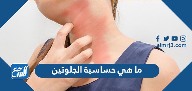 ما هي حساسية الجلوتين