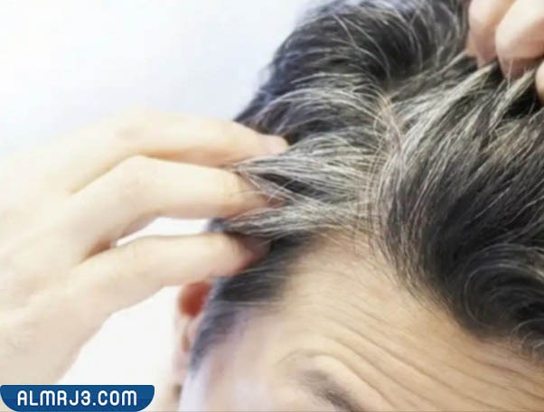 ما هي مشكلة الشيب