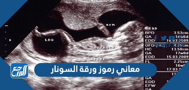 معاني رموز ورقة السونار