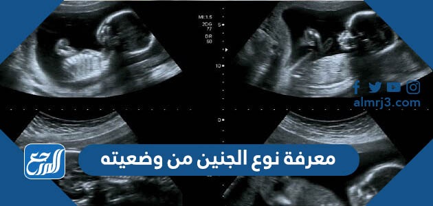 معرفة نوع الجنين من وضعيته